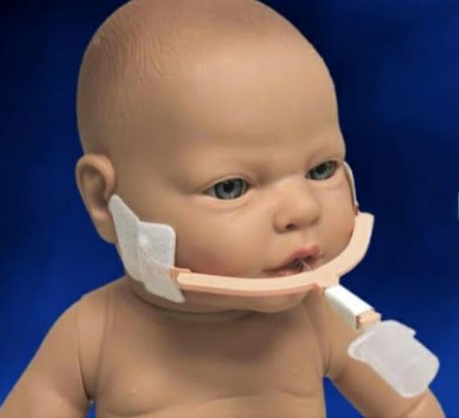 NeoBar® fijadores con hidrocoloides para TET neonatos libre de látex o  DEHP. Neotech® – Minerva Medical